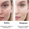 BB CREAM MATE DE ALTA COBERTURA CON PROTECTOR UV Y ÀCIDO HIALURONICO™