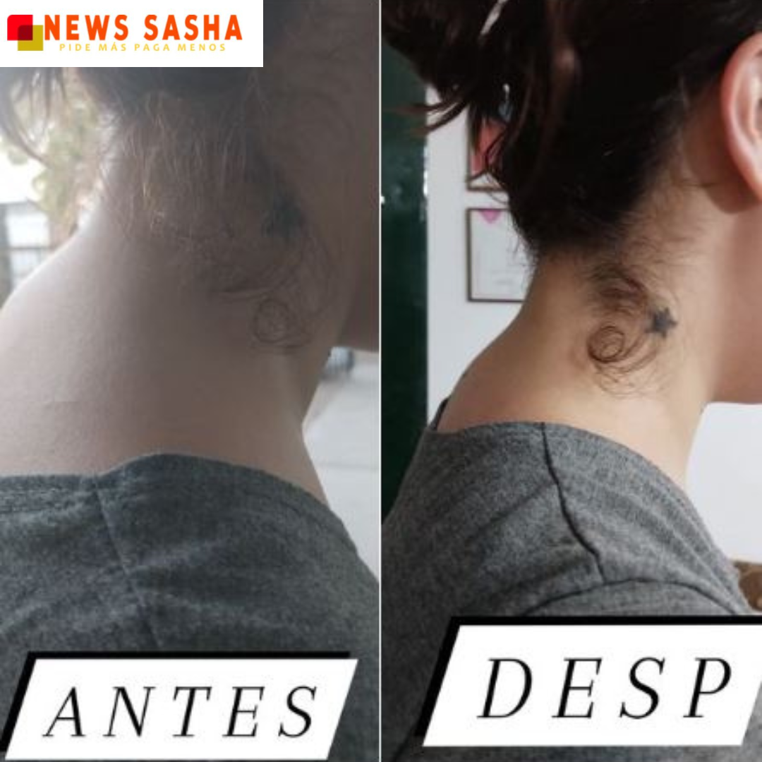 Masajeador Cervical™ | 2x1 ENVIO GRATIS🤩